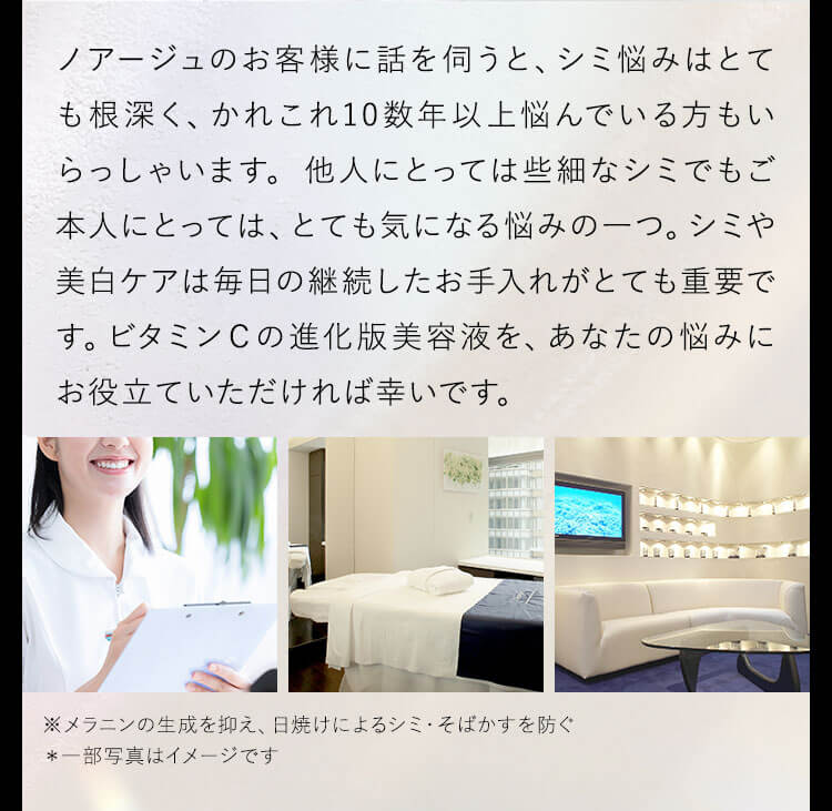 ノアージュのお客様に話を伺うと、シミ悩みはとても根深く、かれこれ10数年以上悩んでいる方もいらっしゃいます。