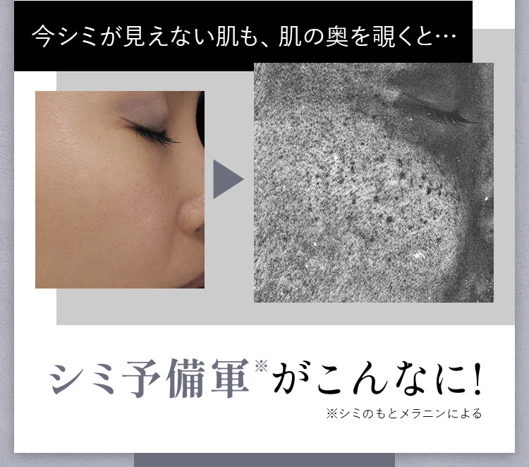 シミ予備軍※がこんなに!