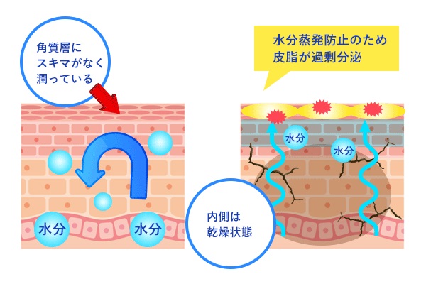 乾燥肌とインナードライの違い