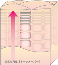 肌環境の整った正常な肌(イメージ図)