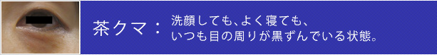 茶クマ:洗顔しても、よく寝ても、いつも目の周りが黒ずんでいる状態。