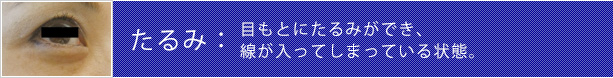 たるみ:目もとにたるみができ、線が入ってしまっている状態。
