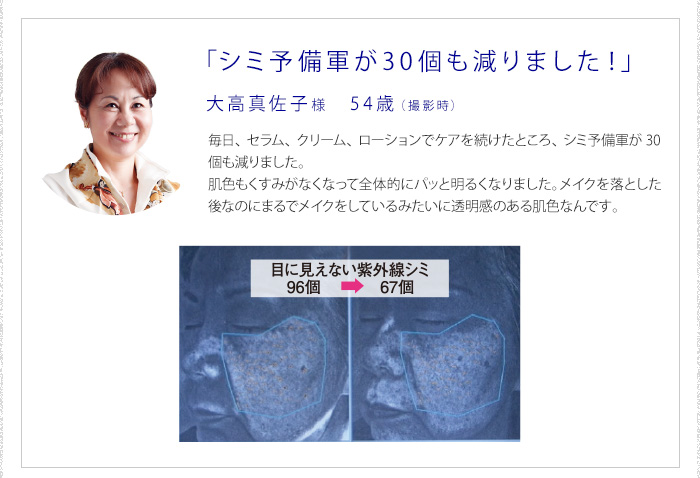 「シミ予備軍が30個も減りました!」