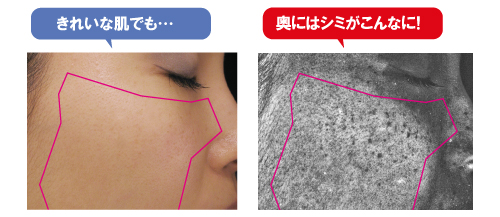 目に見えるシミに!