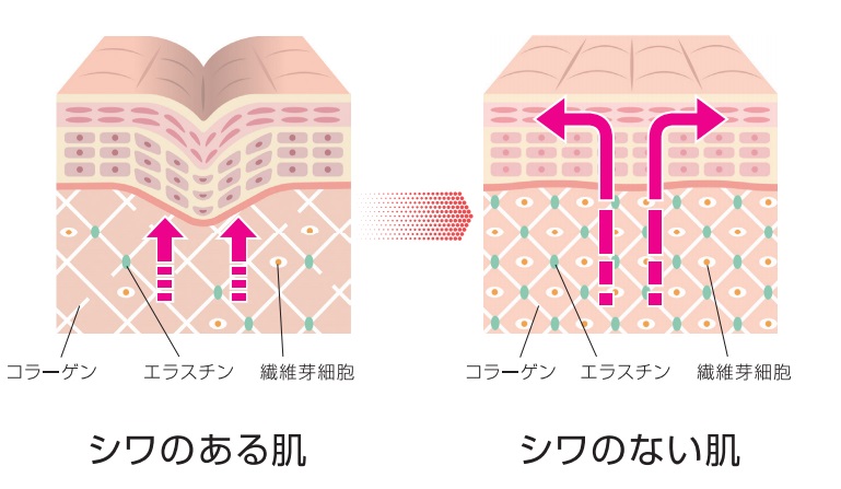 ペプチドのシワ・たるみへの実感力